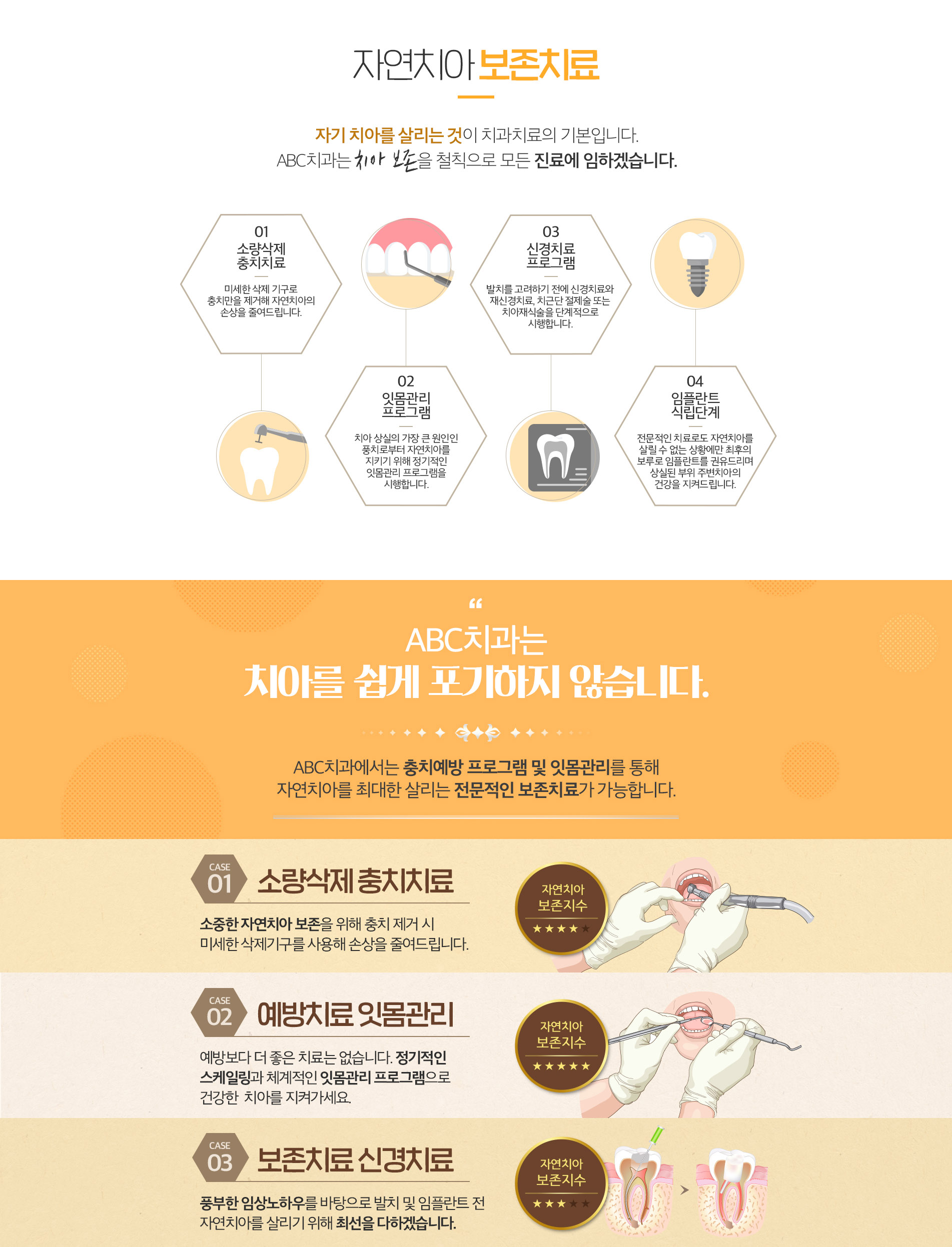 자연치아 보존치료